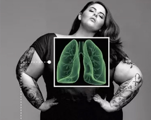 Nursing for Common Symptoms and Signs of Respiratory Diseases