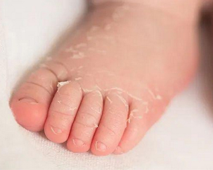 Many childrens have rare diseases, suspected to be related to the new coronavirus!